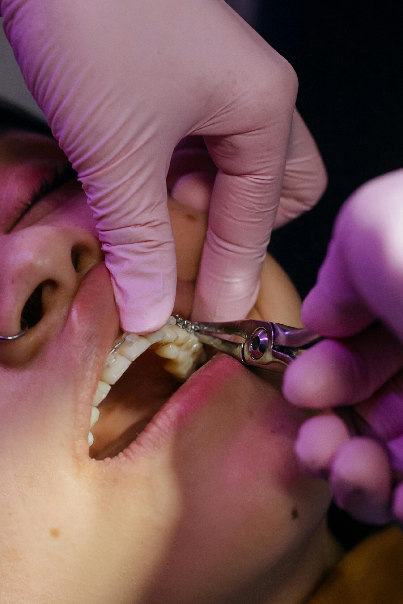 A detailed close-up of a dental procedure showing exam and care by a dentist.